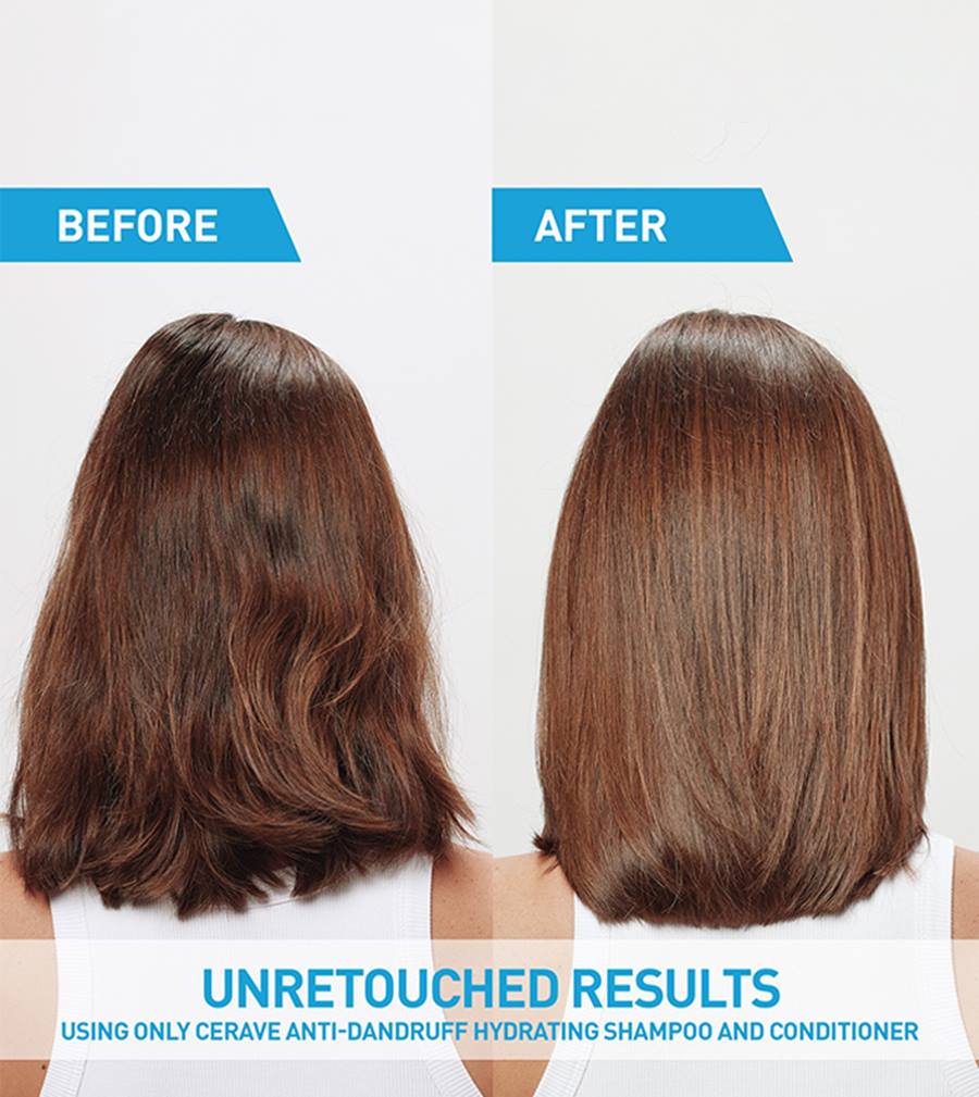 CeraVe Anti-Dandruff Hydrating Shampoo - 355 ML