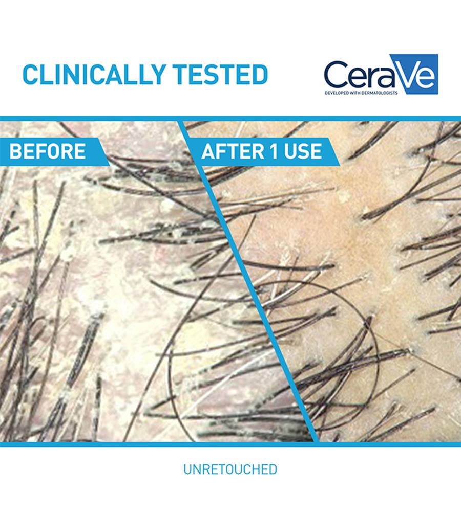 CeraVe Anti-Dandruff Hydrating Shampoo - 355 ML